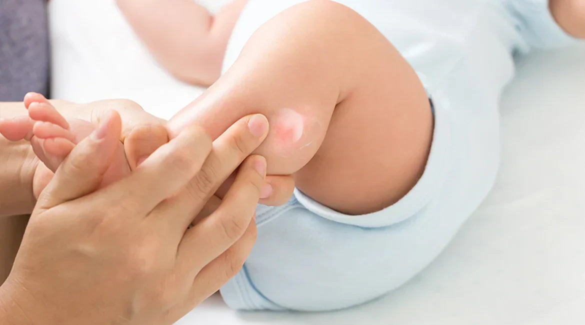7 Winter-Friendly Tips for Preventing Diaper Rash in Babies