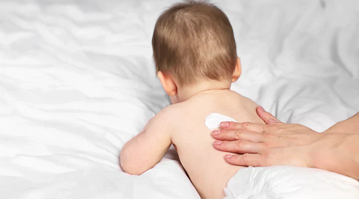 Best Home Remedies for Diaper Rash Relief